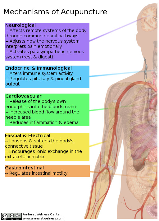 An image showing the different effects acupuncture has on the body.