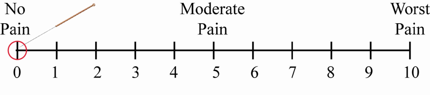 A graphic showing a visual pain scale with an acupuncture needle pointing to zero pain - acupuncture does not hurt.